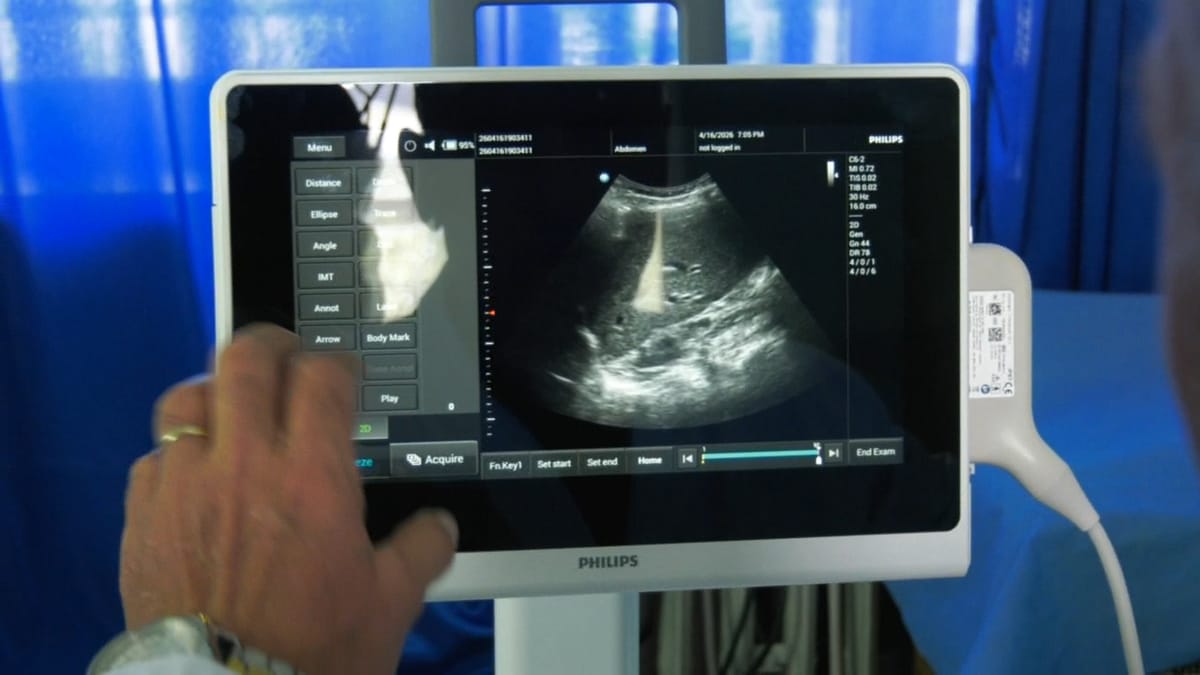 Eko Abdominale e re në Spitalin Bashkiak Mat,