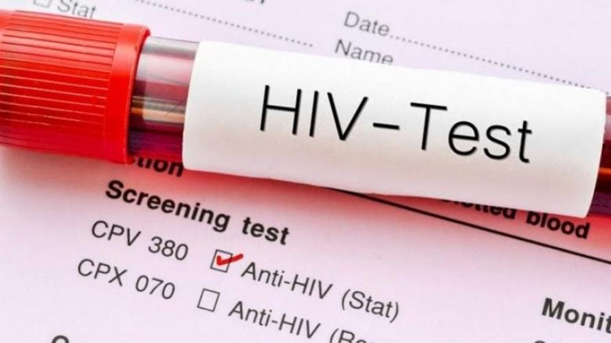 HIV në Shqipëri: Një Rikthim Shqetësues dhe Sfida e Diagnozës së Vonë