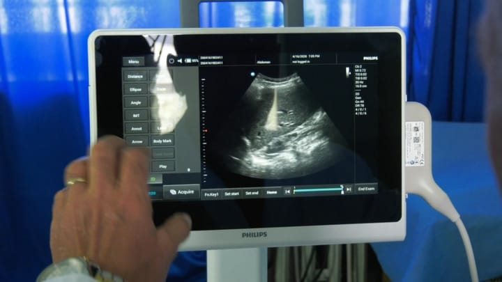 Eko Abdominale e re në Spitalin Bashkiak Mat,